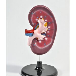 BM037 Presek bubrega sa limfnom žlezdom